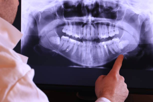 Best Emergency Broken Tooth Repair in Los Altos, CA