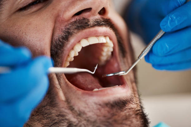 Best Emergency Treatment for Toothache in Los Altos, CA